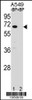 Western blot analysis of ASB3 Antibody Pab pre-incubated without (lane 1) and with (lane 2) blocking peptide in A549 cell line lysate