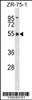 Western blot analysis in ZR-75-1 cell line lysates (35ug/lane) .