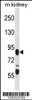 Western blot analysis in mouse kidney tissue lysates (35ug/lane) .