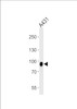 Western blot analysis of lysate from A431 cell line, using DSC3 Antibody at 1:1000 at each lane.