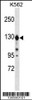 Western blot analysis in K562 cell line lysates (35ug/lane) .