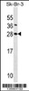 Western blot analysis in SK-BR-3 cell line lysates (35ug/lane) .