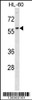 Western blot analysis in HL-60 cell line lysates (35ug/lane) .