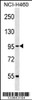 Western blot analysis in NCI-H460 cell line lysates (35ug/lane) .