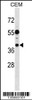 Western blot analysis in CEM cell line lysates (35ug/lane) .