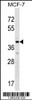 Western blot analysis in MCF-7 cell line lysates (35ug/lane) .