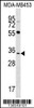 Western blot analysis in MDA-MB453 cell line lysates (35ug/lane) .