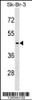 Western blot analysis in SK-BR-3 cell line lysates (35ug/lane) .