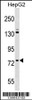 Western blot analysis in HepG2 cell line lysates (35ug/lane) .