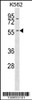 Western blot analysis in K562 cell line lysates (35ug/lane) .