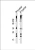 Western Blot at 1:2000 dilution Lane 1: mouse eyeball lysate Lane 2: rat eyeball lysate Lysates/proteins at 20 ug per lane.