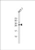 Western Blot at 1:1000 dilution + MCF-7 whole cell lysate Lysates/proteins at 20 ug per lane.