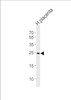 Western blot analysis of lysate from human placenta tissue lysate, using ANP32B Antibody at 1:1000 at each lane.