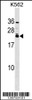 Western blot analysis in K562 cell line lysates (35ug/lane) .