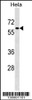 Western blot analysis in Hela cell line lysates (35ug/lane) .