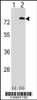 Western blot analysis of PAF1 using rabbit polyclonal PAF1 Antibody using 293 cell lysates (2 ug/lane) either nontransfected (Lane 1) or transiently transfected (Lane 2) with the PAF1 gene.