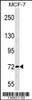 Western blot analysis in MCF-7 cell line lysates (35ug/lane) .