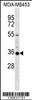 Western blot analysis in MDA-MB453 cell line lysates (35ug/lane) .