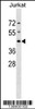 Western blot analysis in Jurkat cell line lysates (35ug/lane) .