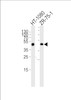 Western blot analysis of lysates from HT-1080, ZR-75-1 cell line (from left to right) , using CRTAP Antibody at 1:1000 at each lane.