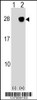 Western blot analysis of ULBP2 using rabbit polyclonal ULBP2 Antibody using 293 cell lysates (2 ug/lane) either nontransfected (Lane 1) or transiently transfected (Lane 2) with the ULBP2 gene.