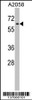 Western blot analysis in A2058 cell line lysates (35ug/lane) .