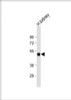 Western Blot at 1:1000 dilution + human kidney lysate Lysates/proteins at 20 ug per lane.