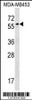 Western blot analysis in MDA-MB453 cell line lysates (35ug/lane) .