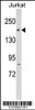 Western blot analysis in Jurkat cell line lysates (35ug/lane) .