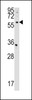 Western blot analysis in HepG2 cell line lysates (35ug/lane) .