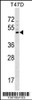 Western blot analysis in T47D cell line lysates (35ug/lane) .