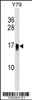 Western blot analysis in Y79 cell line lysates (35ug/lane) .