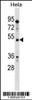 Western blot analysis in Hela cell line lysates (35ug/lane) .