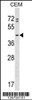 Western blot analysis in CEM cell line lysates (35ug/lane) .