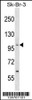 Western blot analysis in SK-BR-3 cell line lysates (35ug/lane) .