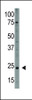 Antibody is used in Western blot to detect PDGFA in HL60 cell lysate.