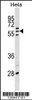 Western blot analysis in Hela cell line lysates (35ug/lane) .