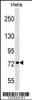 Western blot analysis in Hela cell line lysates (35ug/lane) .