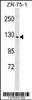 Western blot analysis in ZR-75-1 cell line lysates (35ug/lane) .