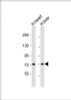 Western Blot at 1:1000 dilution Lane 1: human heart lysate Lane 2: human liver lysate Lysates/proteins at 20 ug per lane.