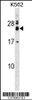 Western blot analysis in K562 cell line lysates (35ug/lane) .