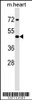 Western blot analysis in mouse heart tissue lysates (35ug/lane) .