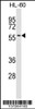 Western blot analysis in HL-60 cell line lysates (35ug/lane) .