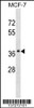 Western blot analysis in MCF-7 cell line lysates (35ug/lane) .