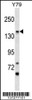 Western blot analysis in Y79 cell line lysates (35ug/lane) .