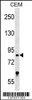 Western blot analysis in CEM cell line lysates (35ug/lane) .