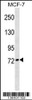 Western blot analysis in MCF-7 cell line lysates (35ug/lane) .