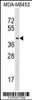 Western blot analysis in MDA-MB453 cell line lysates (35ug/lane) .