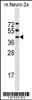 Western blot analysis in mouse Neuro-2a cell line lysates (35ug/lane) .