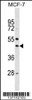 Western blot analysis in MCF-7 cell line lysates (35ug/lane) .